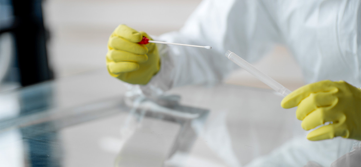 Coronavírus: 5 respostas sobre testes de Covid-19